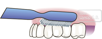 чистка зубных протезов щеткой