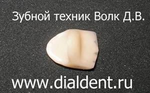 керамическая коронка на передний зуб
