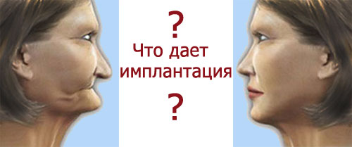преждевременное старение без зубов
