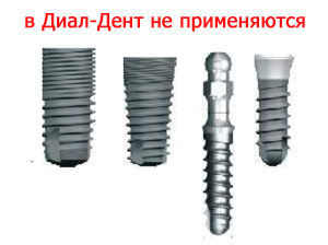 в Диал-Дент не применяют импланты Конмет