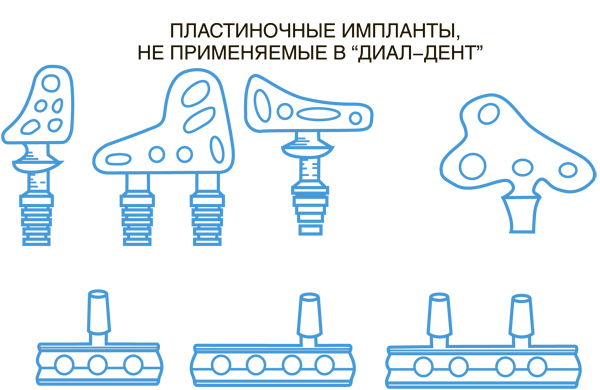 пластиночные импланты в Диал-Дент не применяются